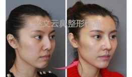 新疆整形爆料案件最新进展,真相逐步浮出水面